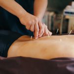 How Acupuncture Benefits You In Daily Life