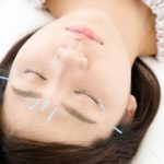 acupuncture for glowing skin