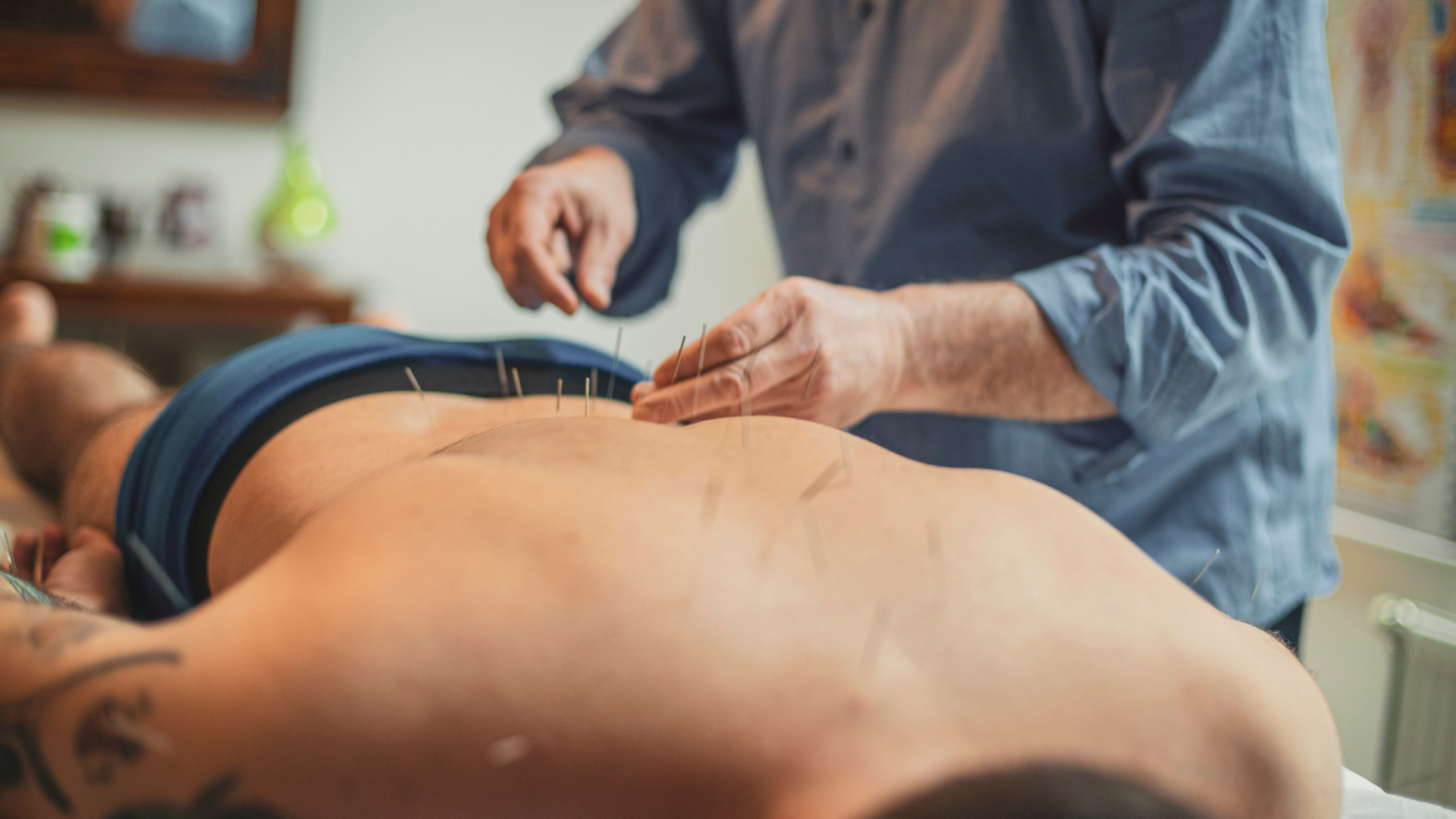 Can Acupuncture Help with Back Pain, Sciatica, and Nerve Pain?